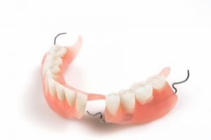 Partial Denture Process