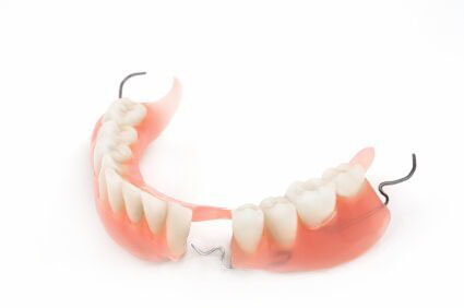 Partial Denture Process